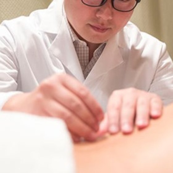 Acupuncture treatment